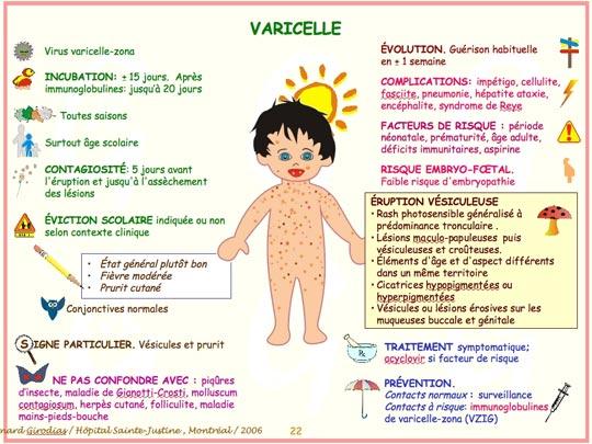 Varicelle tableau